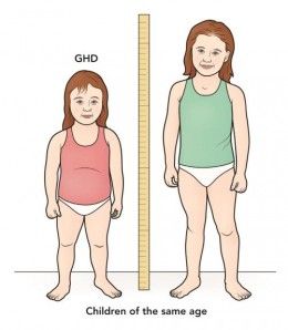 Kids short stature condition - http://india24hourslive.com/kids-short-stature-condition/: 